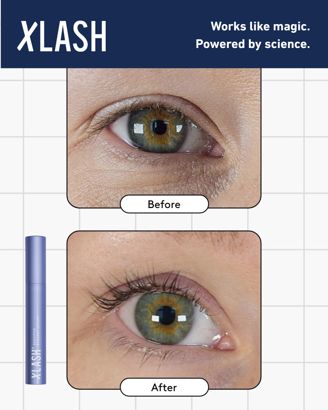 Xlash Eyelash Growth Serum